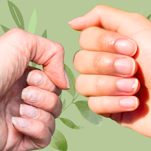 transition from split nails to healthy nails